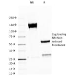 SDS-PAGE - Anti-MUC1 Antibody [MUC1/520] - BSA and Azide free (A252579) - Antibodies.com