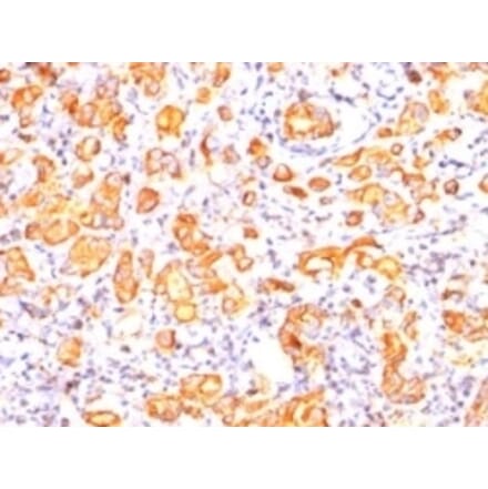 Immunohistochemistry - Anti-MUC1 Antibody [GP1.4] - BSA and Azide free (A252579) - Antibodies.com