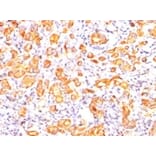 Immunohistochemistry - Anti-MUC1 Antibody [GP1.4] - BSA and Azide free (A252579) - Antibodies.com