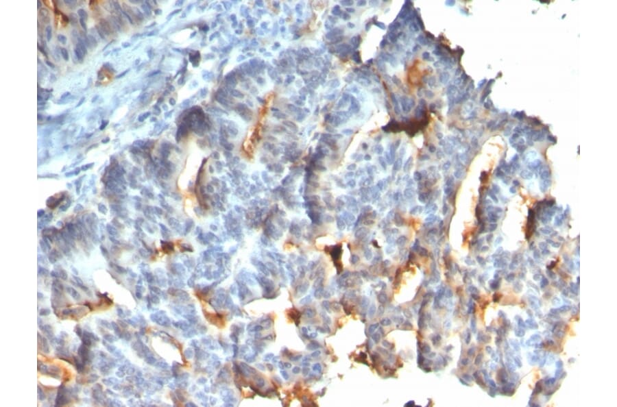 Immunohistochemistry - Anti-MUC1 Antibody [rMUC1/955] - BSA and Azide free (A252581) - Antibodies.com