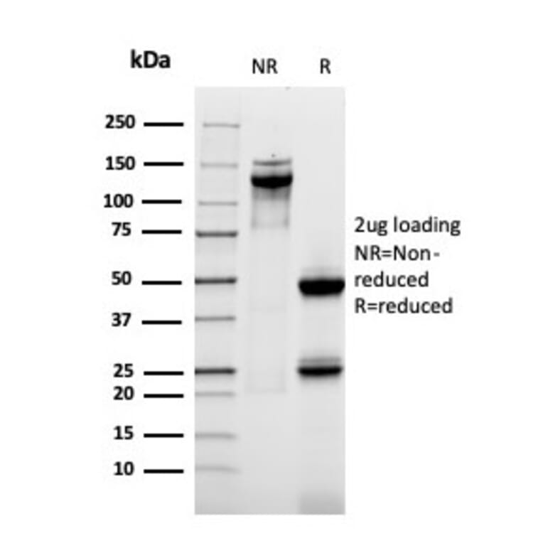 SDS-PAGE - Anti-MUC1 Antibody [rMUC1/955] - BSA and Azide free (A252582) - Antibodies.com