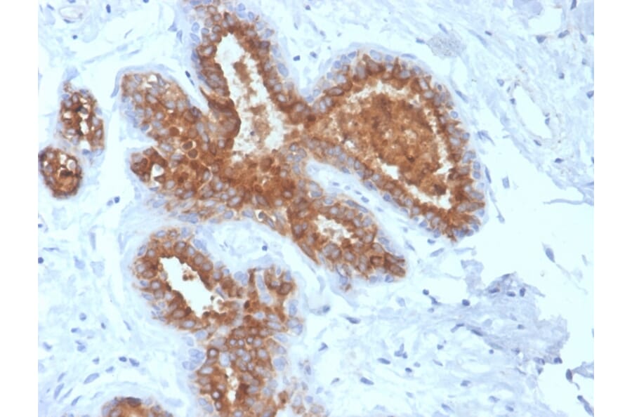 Immunohistochemistry - Anti-MUC1 Antibody [rMUC1/4418] - BSA and Azide free (A252582) - Antibodies.com