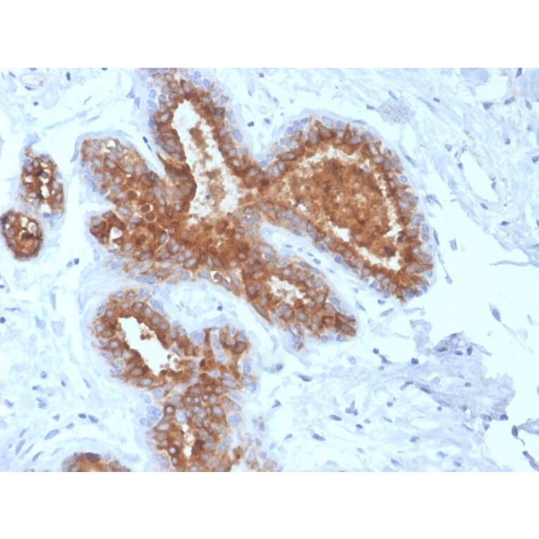 Immunohistochemistry - Anti-MUC1 Antibody [rMUC1/4418] - BSA and Azide free (A252582) - Antibodies.com
