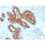 Immunohistochemistry - Anti-MUC1 Antibody [rMUC1/4418] - BSA and Azide free (A252582) - Antibodies.com