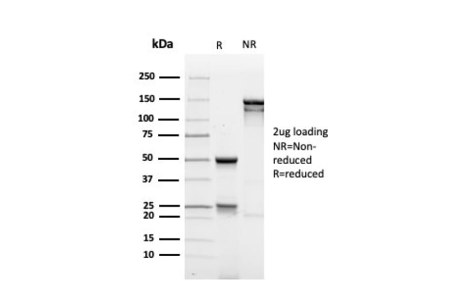 SDS-PAGE - Anti-MUC1 Antibody [rMUC1/4418] - BSA and Azide free (A252583) - Antibodies.com