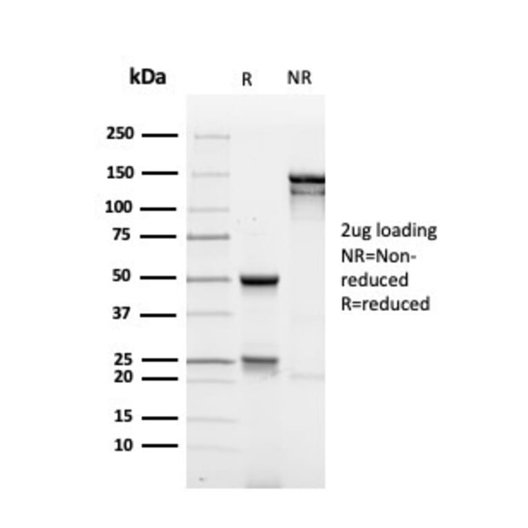 SDS-PAGE - Anti-MUC1 Antibody [rMUC1/4418] - BSA and Azide free (A252583) - Antibodies.com