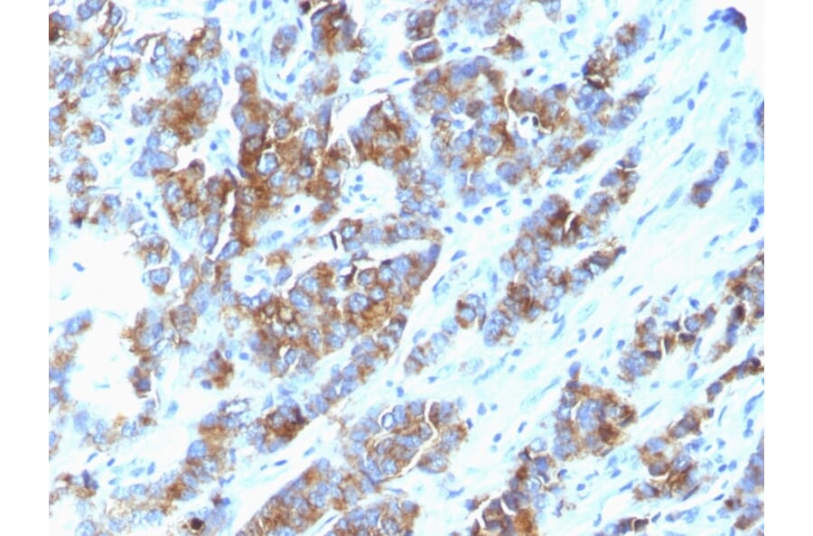 Immunohistochemistry - Anti-MUC1 Antibody [SPM533] - BSA and Azide free (A249405) - Antibodies.com