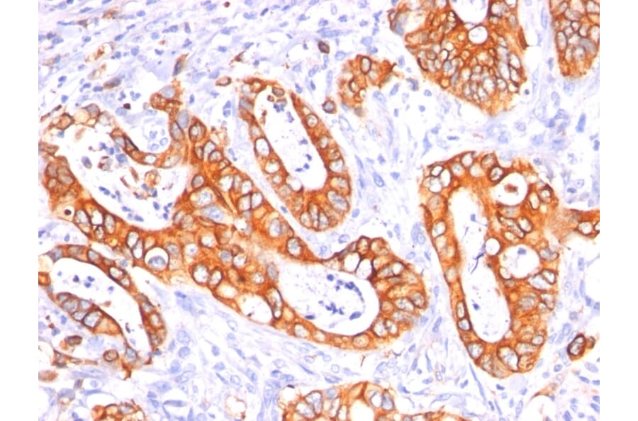 Immunohistochemistry - Anti-MUC1 Antibody [GP1.4 + E29] - BSA and Azide free (A252585) - Antibodies.com