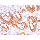 Immunohistochemistry - Anti-MUC1 Antibody [GP1.4 + E29] - BSA and Azide free (A252585) - Antibodies.com