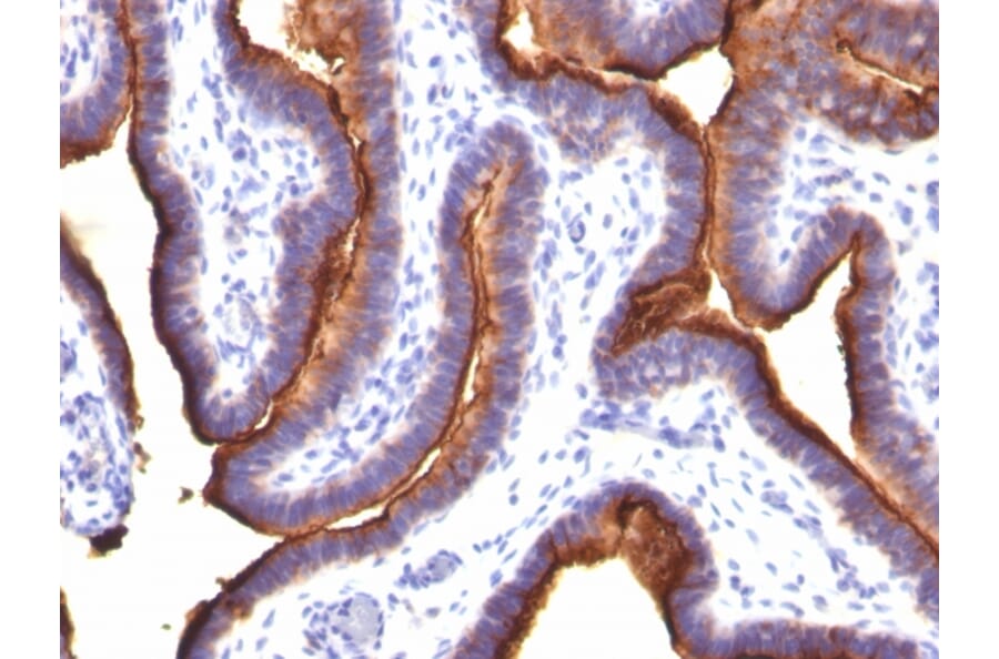 Immunohistochemistry - Anti-MUC1 Antibody [MUC1/845] - BSA and Azide free (A252587) - Antibodies.com