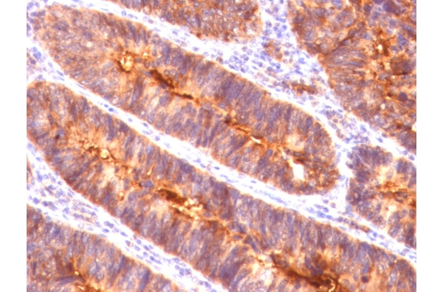 Immunohistochemistry - Anti-MUC1 Antibody [MUC1/845] - BSA and Azide free (A252587) - Antibodies.com