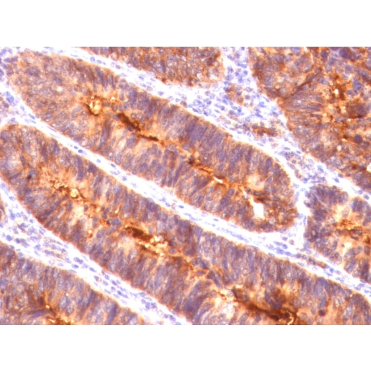 Immunohistochemistry - Anti-MUC1 Antibody [MUC1/845] - BSA and Azide free (A252587) - Antibodies.com