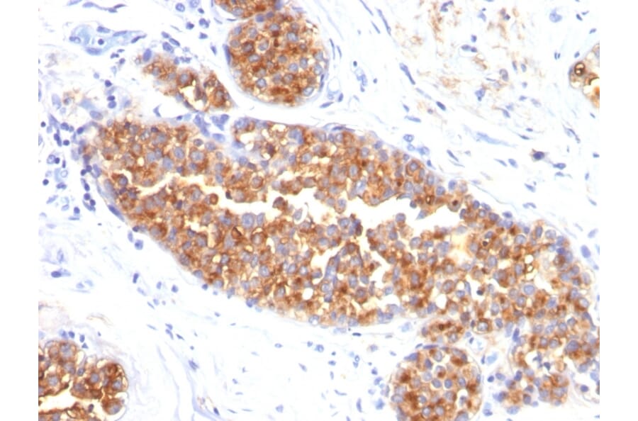 Immunohistochemistry - Anti-MUC1 Antibody [MUC1/845] - BSA and Azide free (A252587) - Antibodies.com