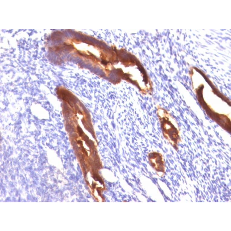 Immunohistochemistry - Anti-MUC1 Antibody [MUC1/845] - BSA and Azide free (A252587) - Antibodies.com