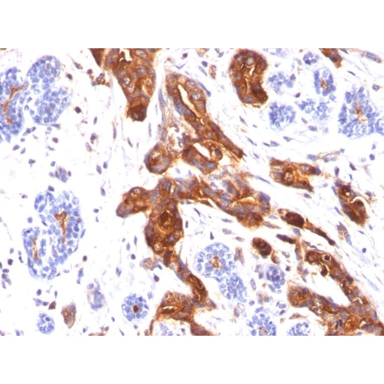 Immunohistochemistry - Anti-MUC1 Antibody [MUC1/845] - BSA and Azide free (A252586) - Antibodies.com
