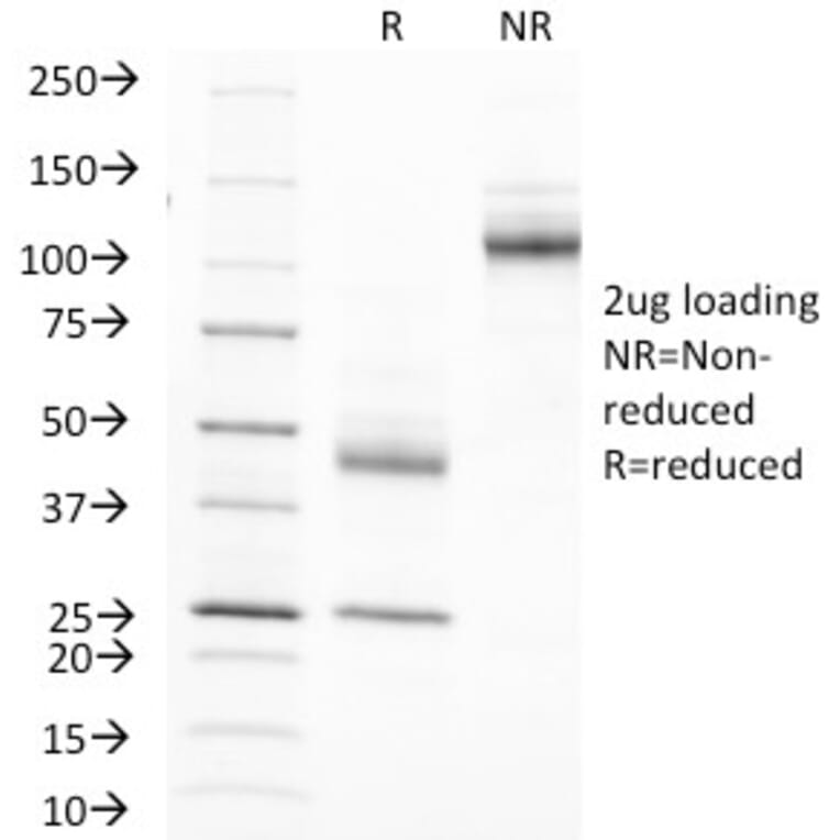 SDS-PAGE - Anti-MUC1 Antibody [MUC1/845] - BSA and Azide free (A252587) - Antibodies.com