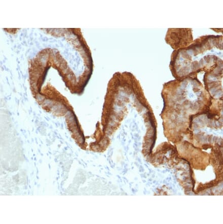 Immunohistochemistry - Anti-MUC1 Antibody [SPM493] - BSA and Azide free (A252589) - Antibodies.com