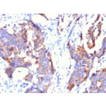 Immunohistochemistry - Anti-MUC1 Antibody [115D8] - BSA and Azide free (A252591) - Antibodies.com