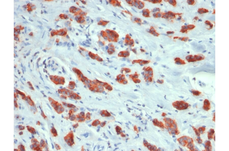 Immunohistochemistry - Anti-MUC1 Antibody [MUC1/1887R] - BSA and Azide free (A252591) - Antibodies.com