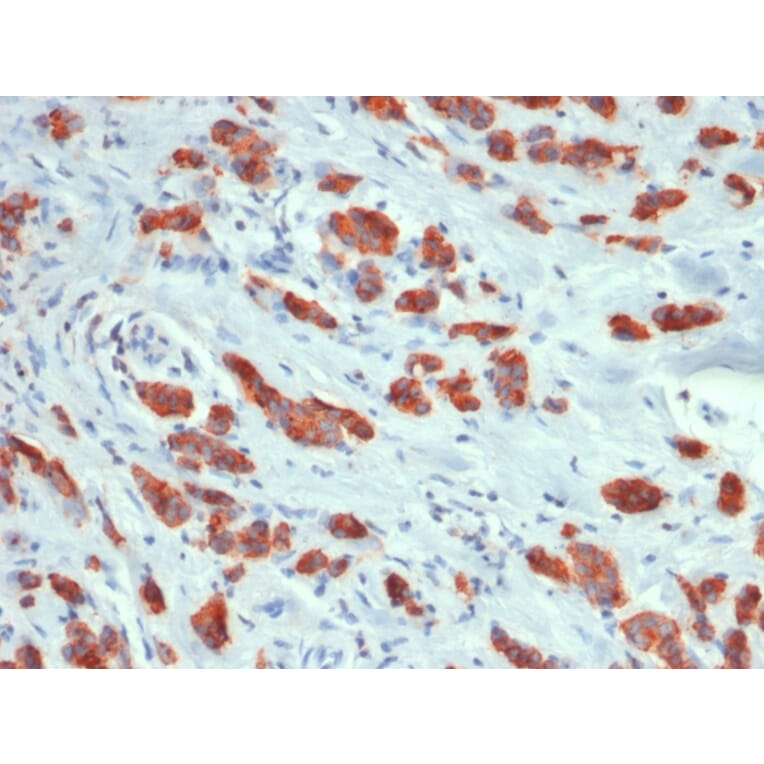 Immunohistochemistry - Anti-MUC1 Antibody [MUC1/1887R] - BSA and Azide free (A252591) - Antibodies.com