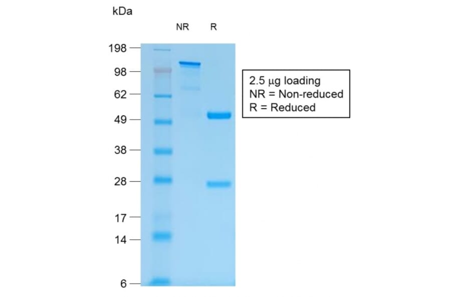 SDS-PAGE - Anti-MUC1 Antibody [MUC1/1887R] - BSA and Azide free (A252592) - Antibodies.com