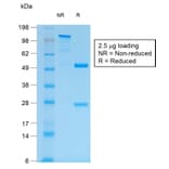 SDS-PAGE - Anti-MUC1 Antibody [MUC1/1887R] - BSA and Azide free (A252592) - Antibodies.com