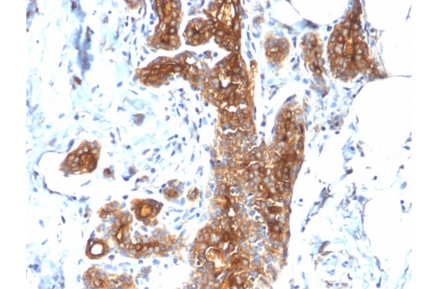 Immunohistochemistry - Anti-MUC1 Antibody [MUC1/2278R] - BSA and Azide free (A249413) - Antibodies.com