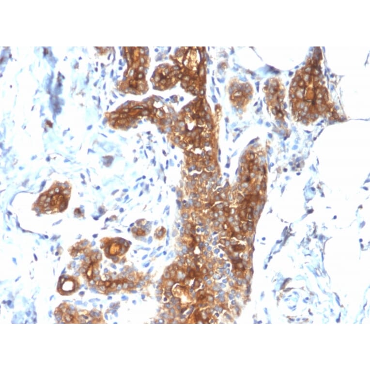 Immunohistochemistry - Anti-MUC1 Antibody [MUC1/2278R] - BSA and Azide free (A249413) - Antibodies.com