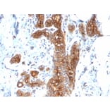 Immunohistochemistry - Anti-MUC1 Antibody [MUC1/2278R] - BSA and Azide free (A249413) - Antibodies.com