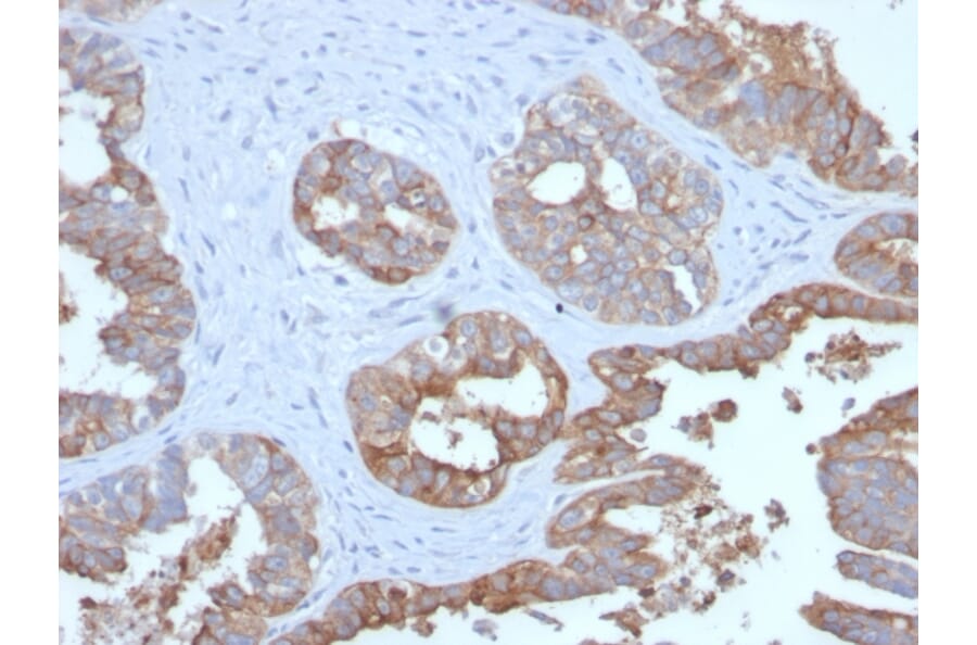 Immunohistochemistry - Anti-MUC1 Antibody [MUC1/2729R] - BSA and Azide free (A252593) - Antibodies.com