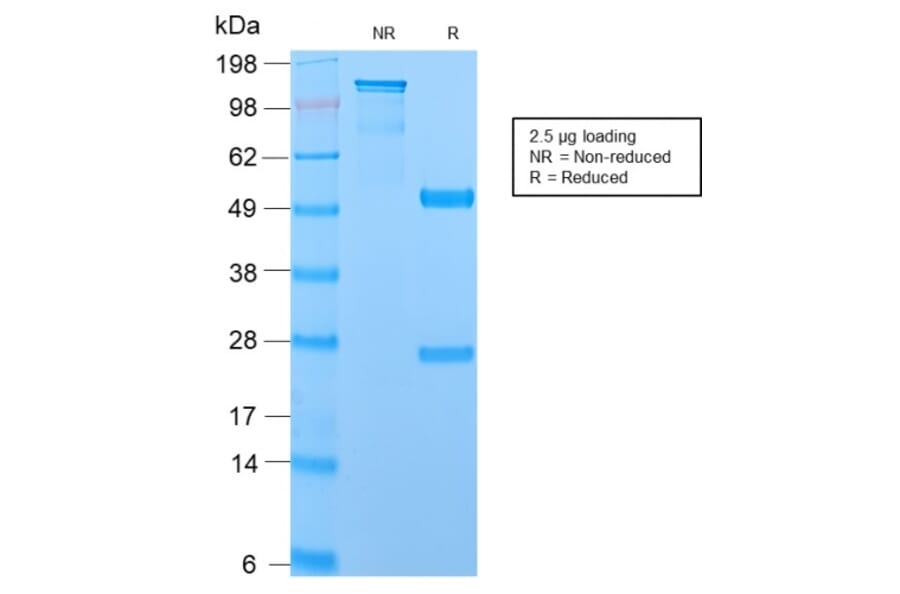 SDS-PAGE - Anti-MUC1 Antibody [MUC1/2729R] - BSA and Azide free (A252594) - Antibodies.com