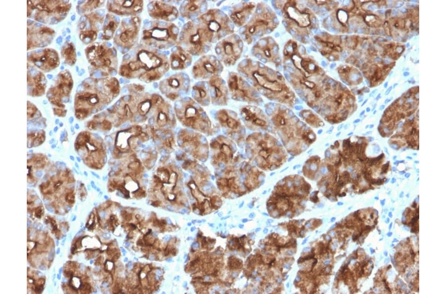 Immunohistochemistry - Anti-MUC1 Antibody [MUC1/2818R] - BSA and Azide free (A252595) - Antibodies.com