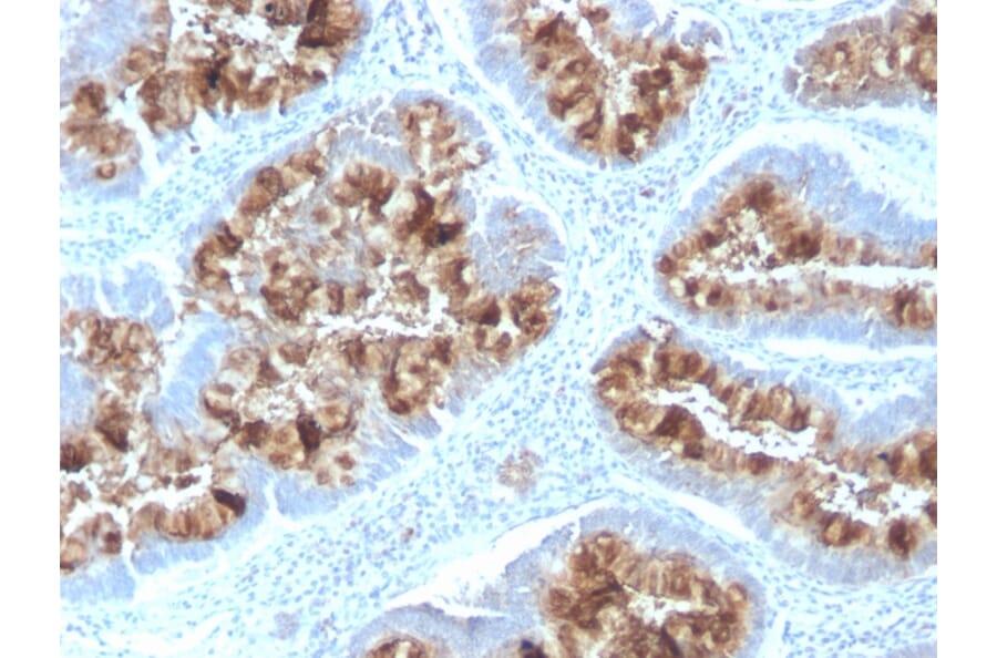 Immunohistochemistry - Anti-MUC1 Antibody [MUC1/2818R] - BSA and Azide free (A252594) - Antibodies.com