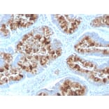 Immunohistochemistry - Anti-MUC1 Antibody [MUC1/2818R] - BSA and Azide free (A252594) - Antibodies.com