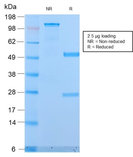 Recombinant Anti-MUC1 Antibody [MUC1/2818R] (A252595) | Antibodies.com