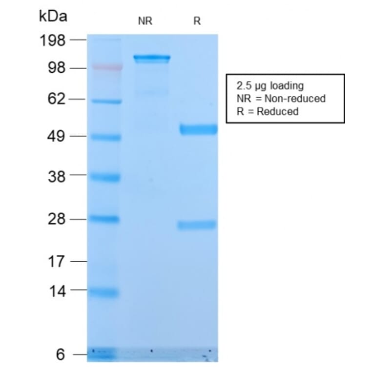 SDS-PAGE - Anti-MUC1 Antibody [MUC1/2818R] - BSA and Azide free (A252595) - Antibodies.com