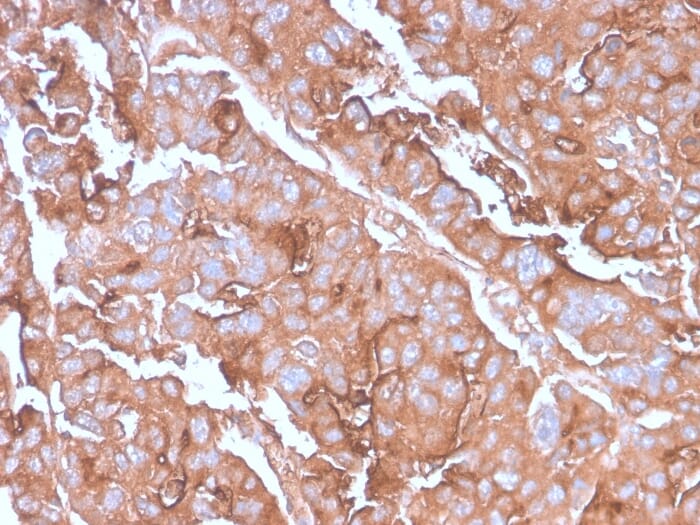 Recombinant Anti-MUC1 Antibody [MUC1/2980R] (A252596) | Antibodies.com
