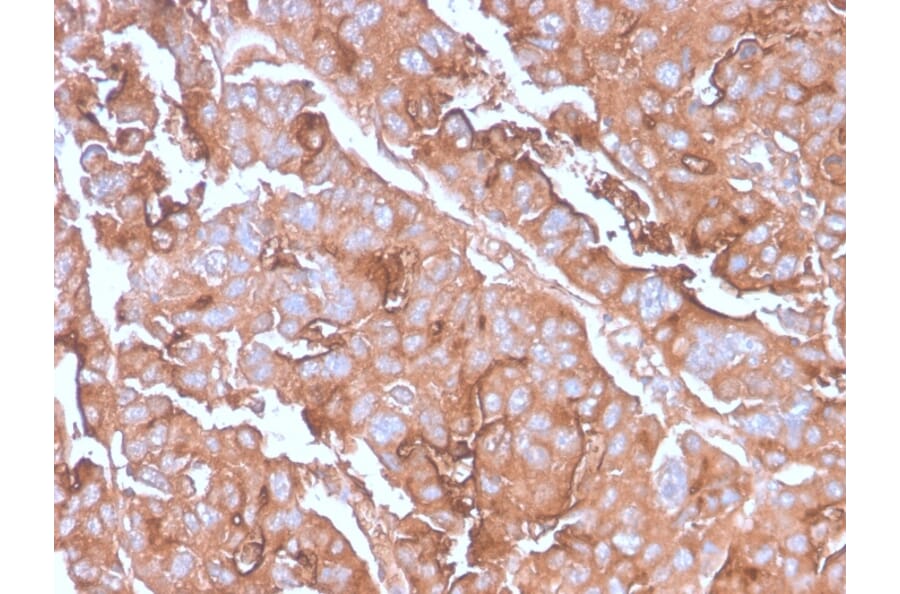 Immunohistochemistry - Anti-MUC1 Antibody [MUC1/2980R] - BSA and Azide free (A249416) - Antibodies.com
