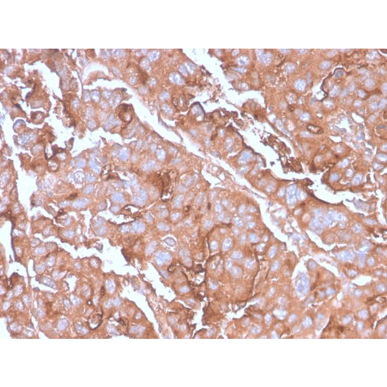 Immunohistochemistry - Anti-MUC1 Antibody [MUC1/2980R] - BSA and Azide free (A249416) - Antibodies.com
