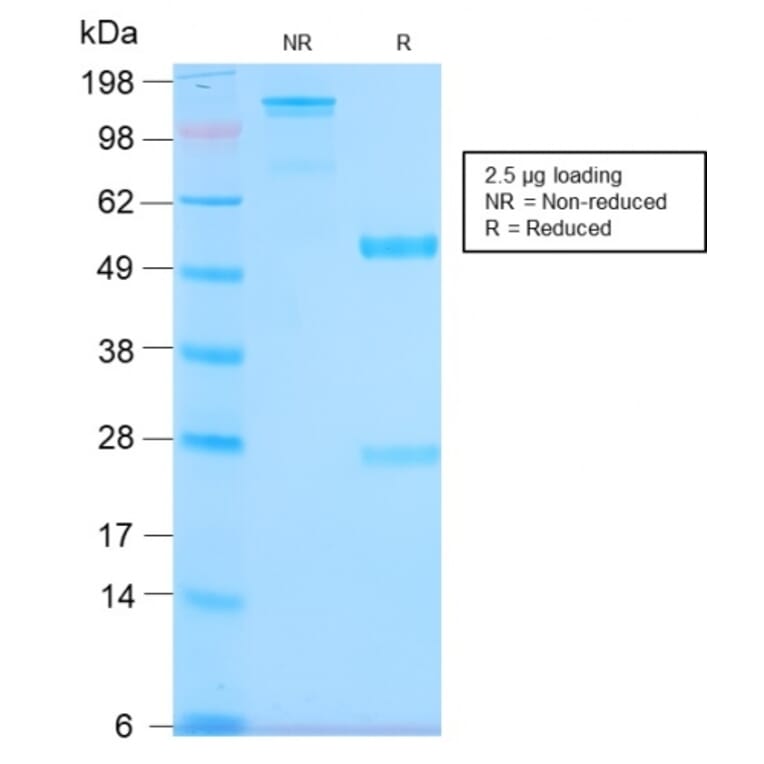 SDS-PAGE - Anti-MUC1 Antibody [MUC1/2980R] - BSA and Azide free (A249416) - Antibodies.com
