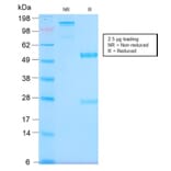 SDS-PAGE - Anti-MUC1 Antibody [MUC1/2980R] - BSA and Azide free (A249416) - Antibodies.com