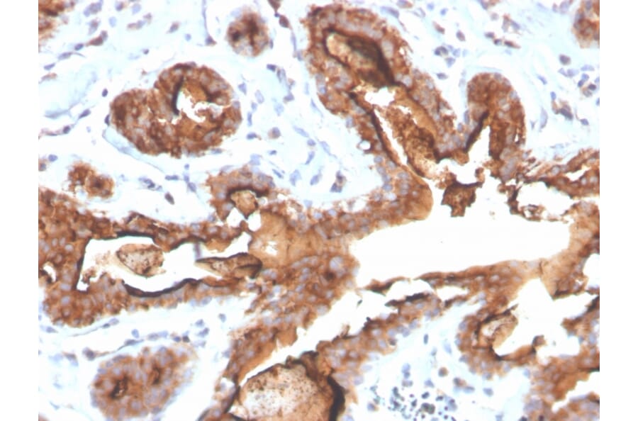Immunohistochemistry - Anti-MUC1 Antibody [MUC1/4416R] - BSA and Azide free (A252597) - Antibodies.com