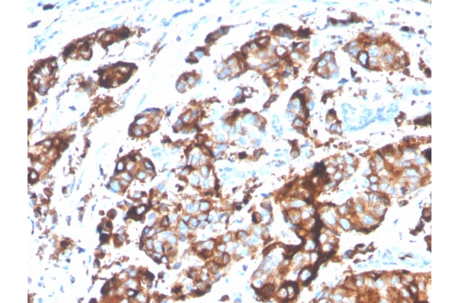 Immunohistochemistry - Anti-MUC1 Antibody [MUC1/4416R] - BSA and Azide free (A252596) - Antibodies.com
