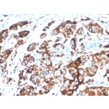 Immunohistochemistry - Anti-MUC1 Antibody [MUC1/4416R] - BSA and Azide free (A252596) - Antibodies.com