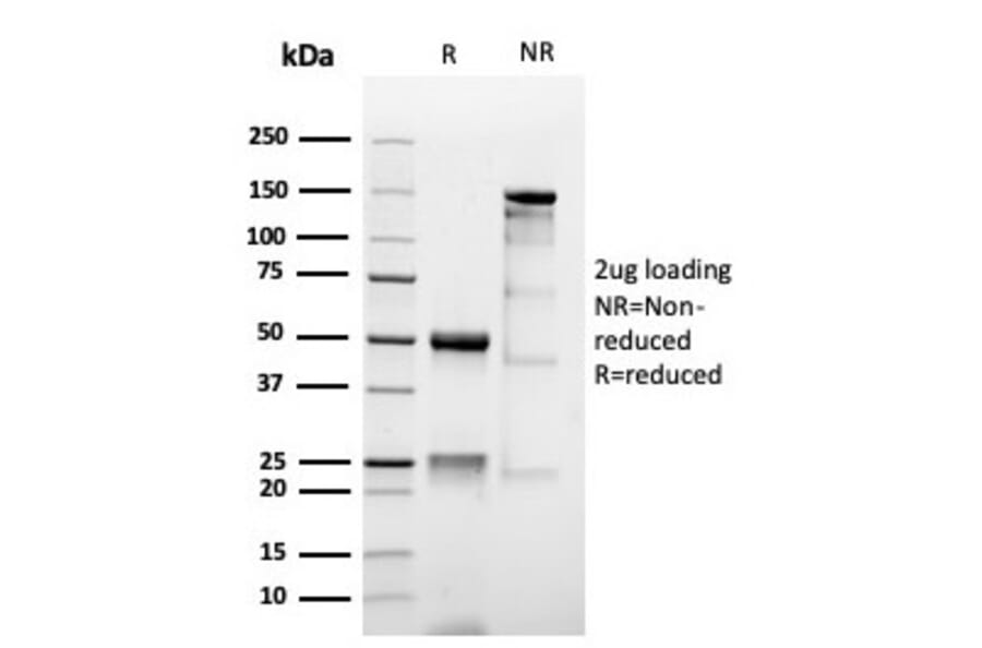 SDS-PAGE - Anti-MUC1 Antibody [MUC1/4416R] - BSA and Azide free (A252597) - Antibodies.com