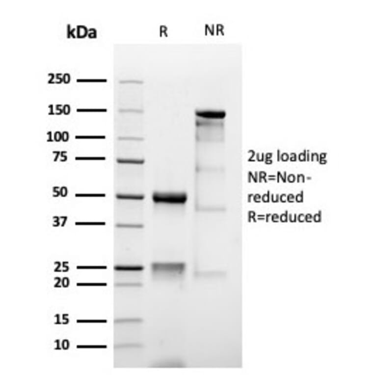 SDS-PAGE - Anti-MUC1 Antibody [MUC1/4416R] - BSA and Azide free (A252597) - Antibodies.com