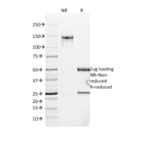 SDS-PAGE - Anti-MUC2 Antibody [SPM513] - BSA and Azide free (A252600) - Antibodies.com