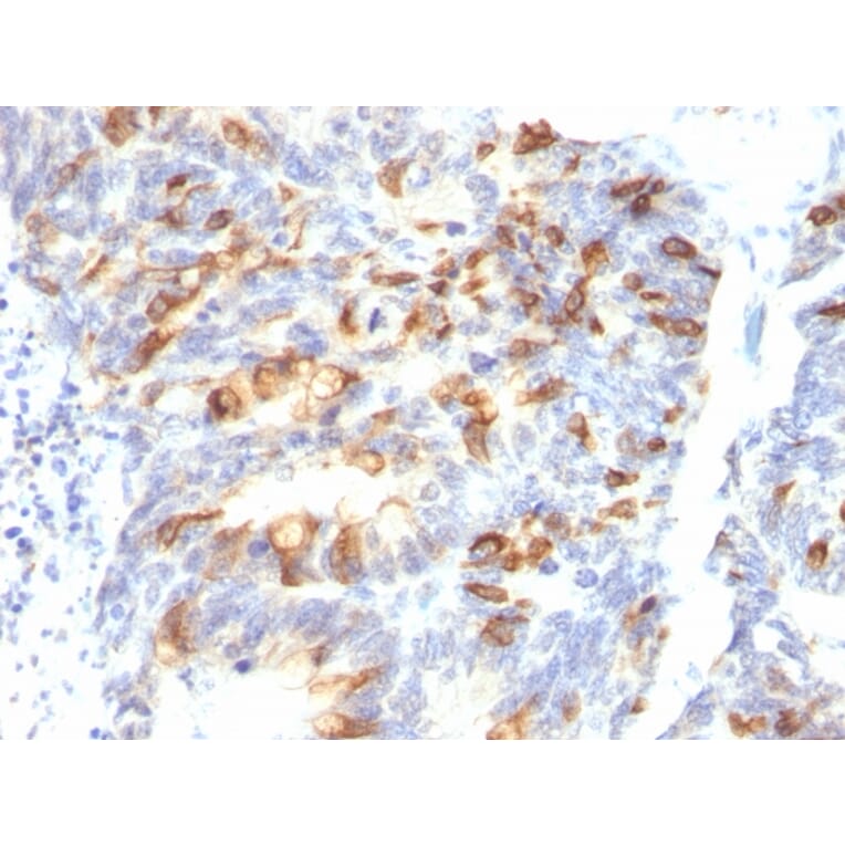 Immunohistochemistry - Anti-MUC2 Antibody [MLP/842] - BSA and Azide free (A252601) - Antibodies.com