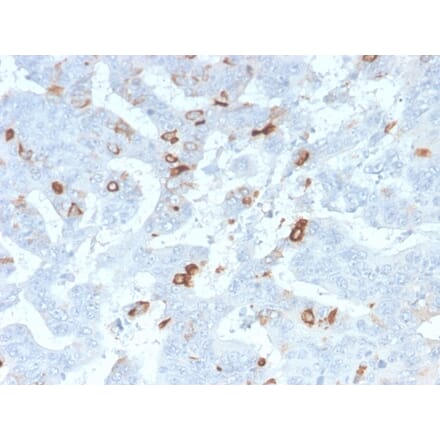 Immunohistochemistry - Anti-MUC2 Antibody [MLP/2970R] - BSA and Azide free (A252602) - Antibodies.com