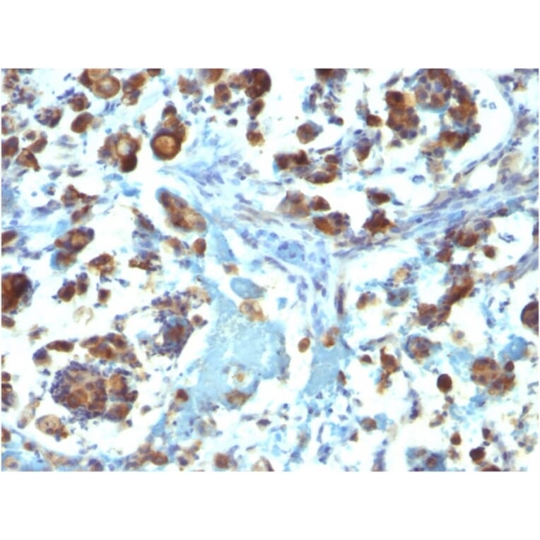 Immunohistochemistry - Anti-MUC3 Antibody [M3.1] - BSA and Azide free (A252604) - Antibodies.com